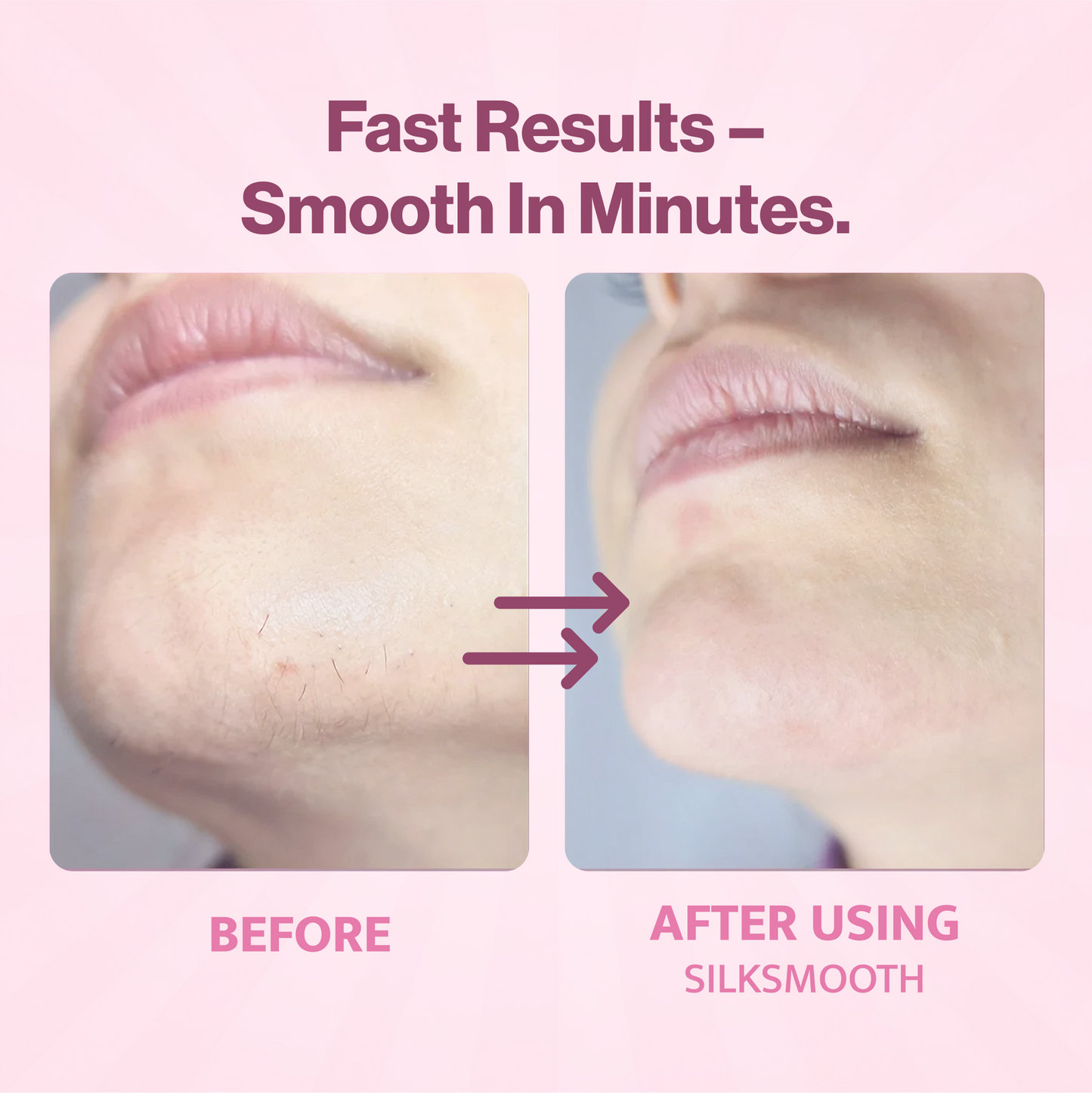 SilkSmooth – Hair Removal Cream (50% OFF)